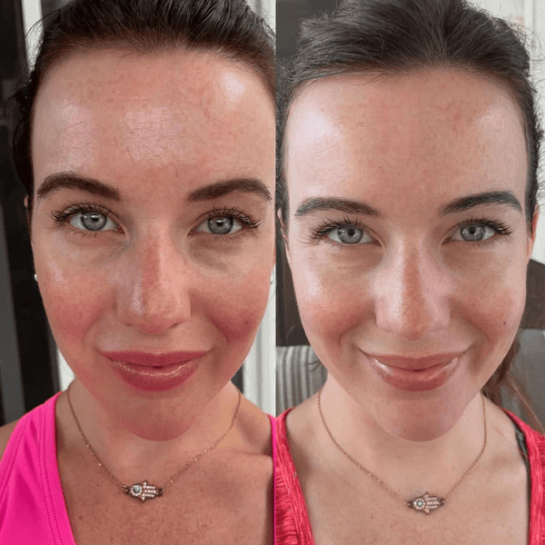 ReviveLight Ritual™ LED Mask - Radiant Revive