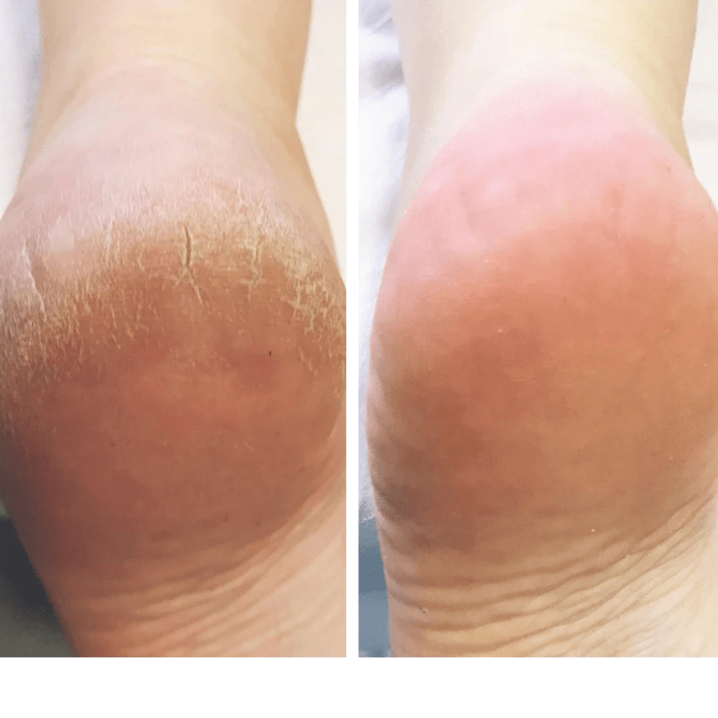 ReviveSmooth Touch™ Foot File - Radiant Revive