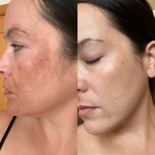 ReviveLight Ritual™ LED Mask - Radiant Revive