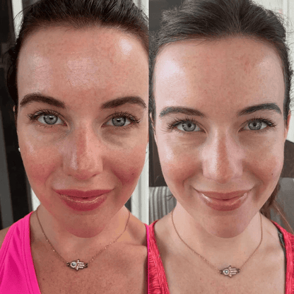 ReviveLight Ritual™ LED Mask - Radiant Revive