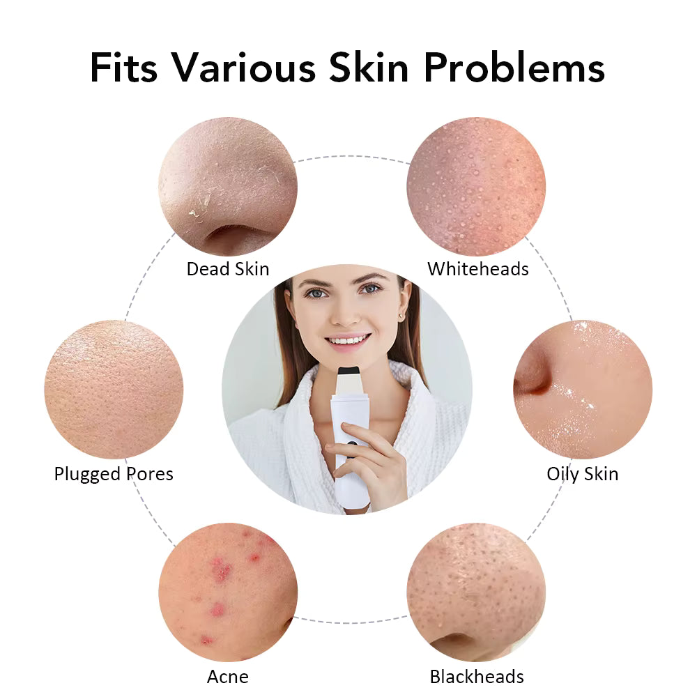 Facial Skin Scrubber